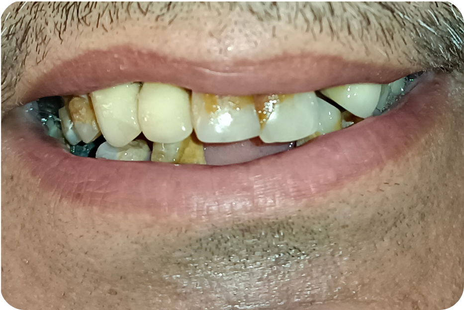 Before image