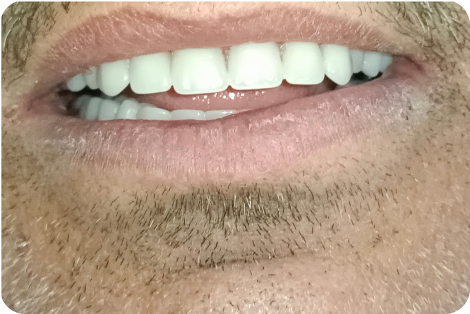 After image