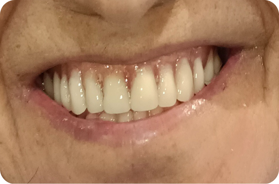 After image
