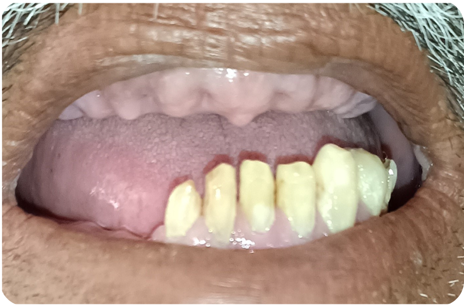 Before image