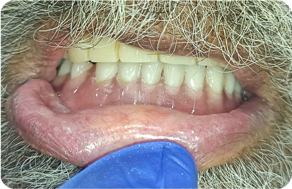After image