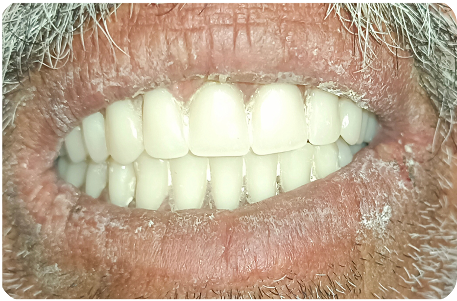 After image
