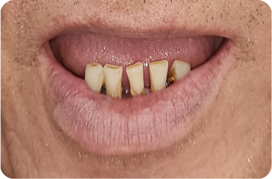 Before image