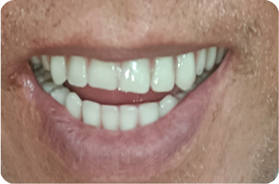 After image