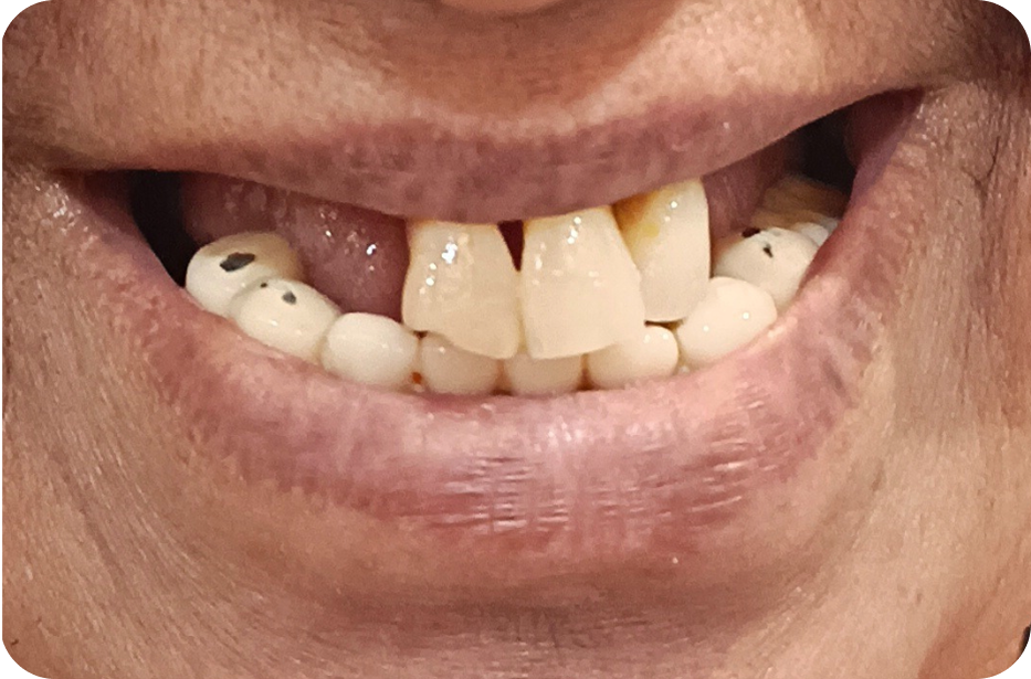 Before image