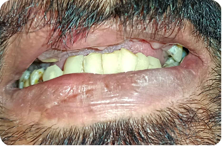 Before image