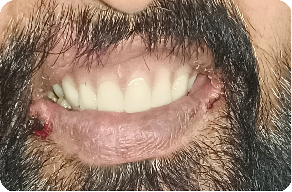 After image