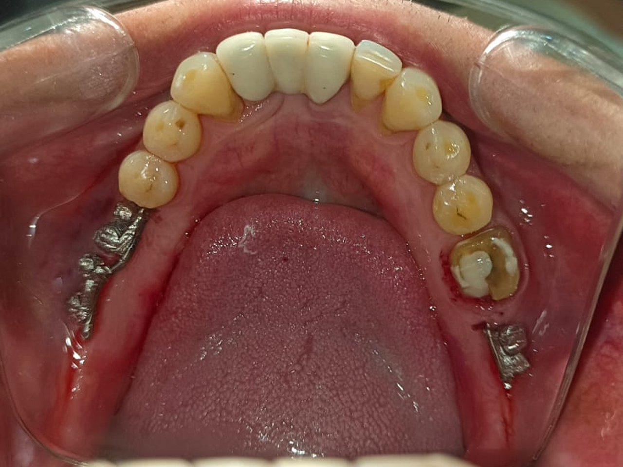 image-3
