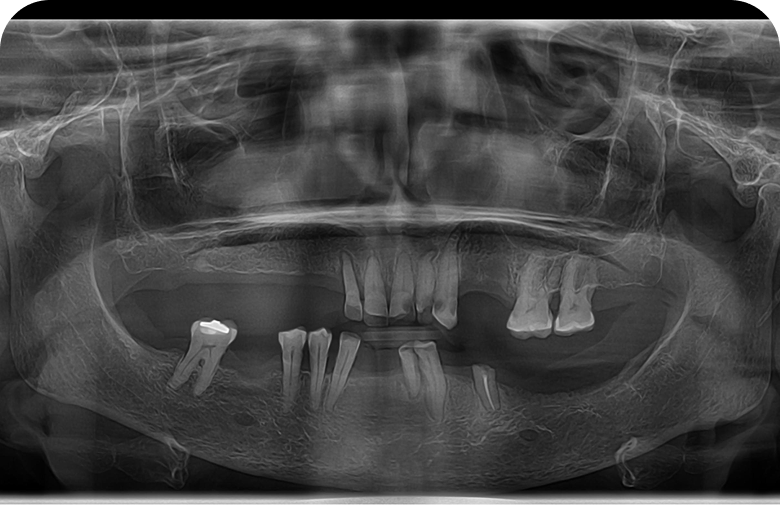 Before image