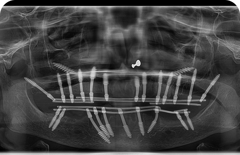 After image