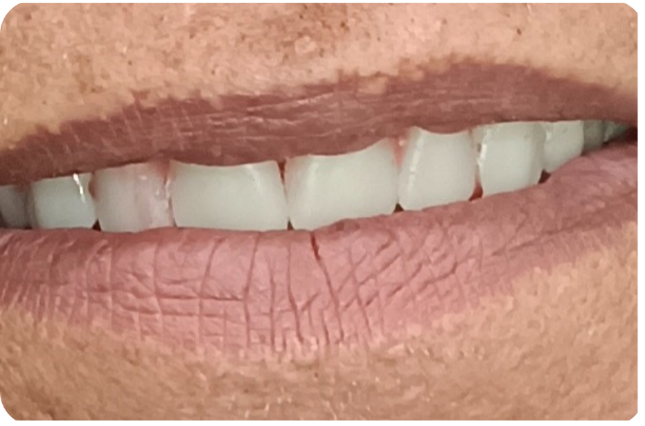 After image