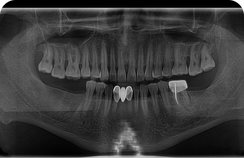 Before image