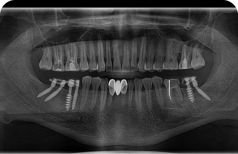 After image