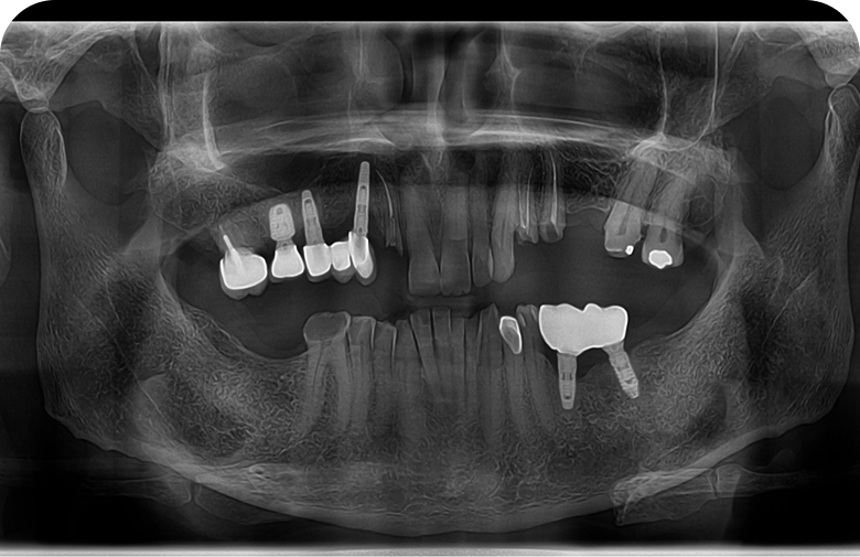 Before image