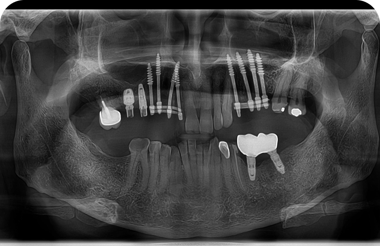 After image