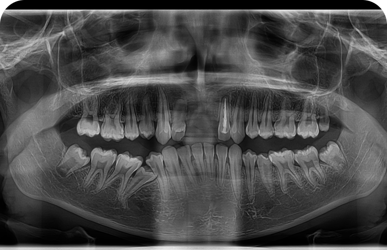 Before image