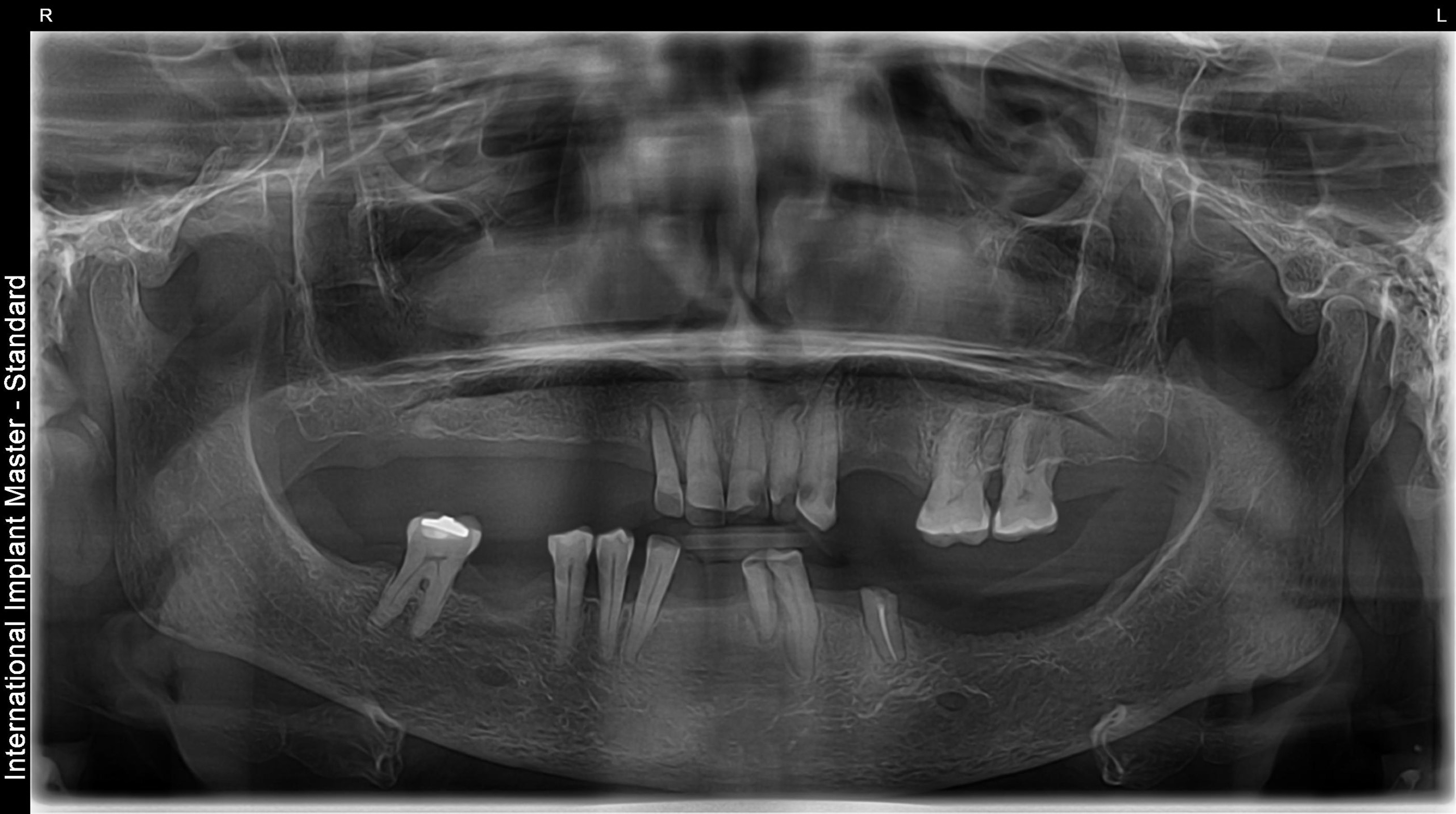 Before image