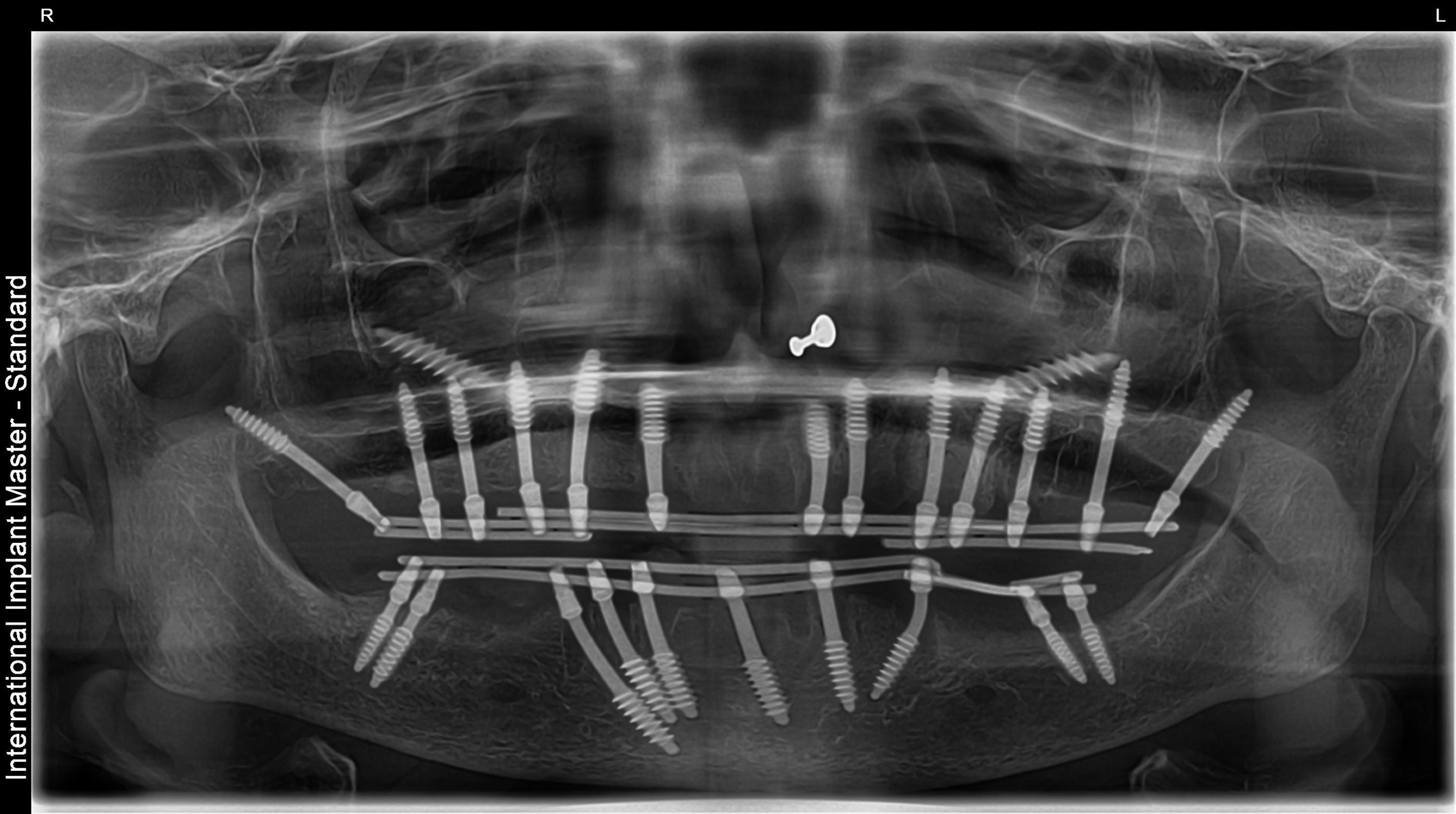 After image