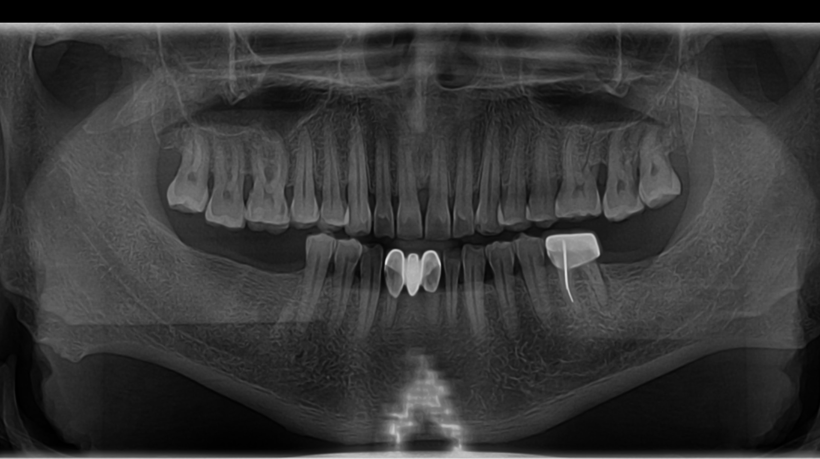 Before image