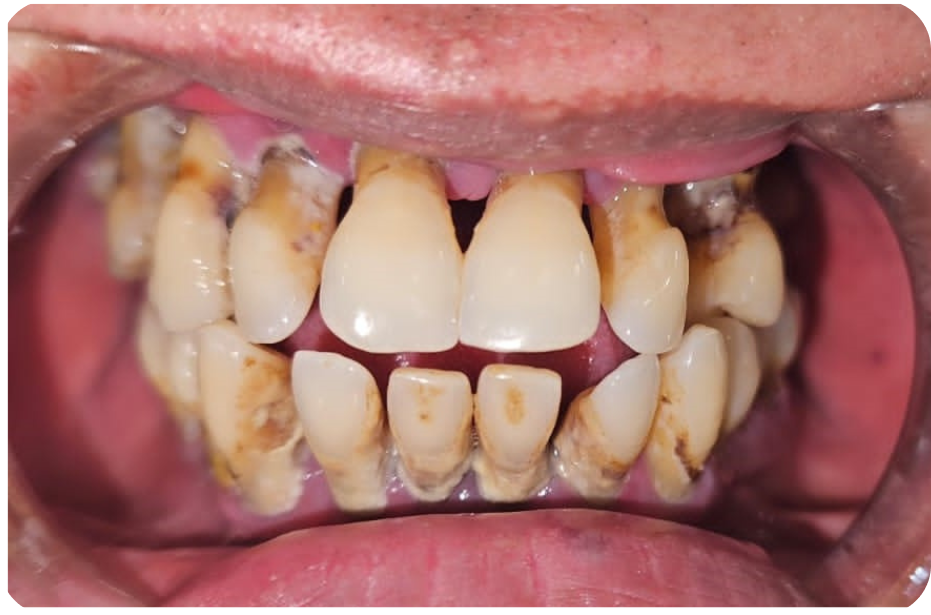 Before image