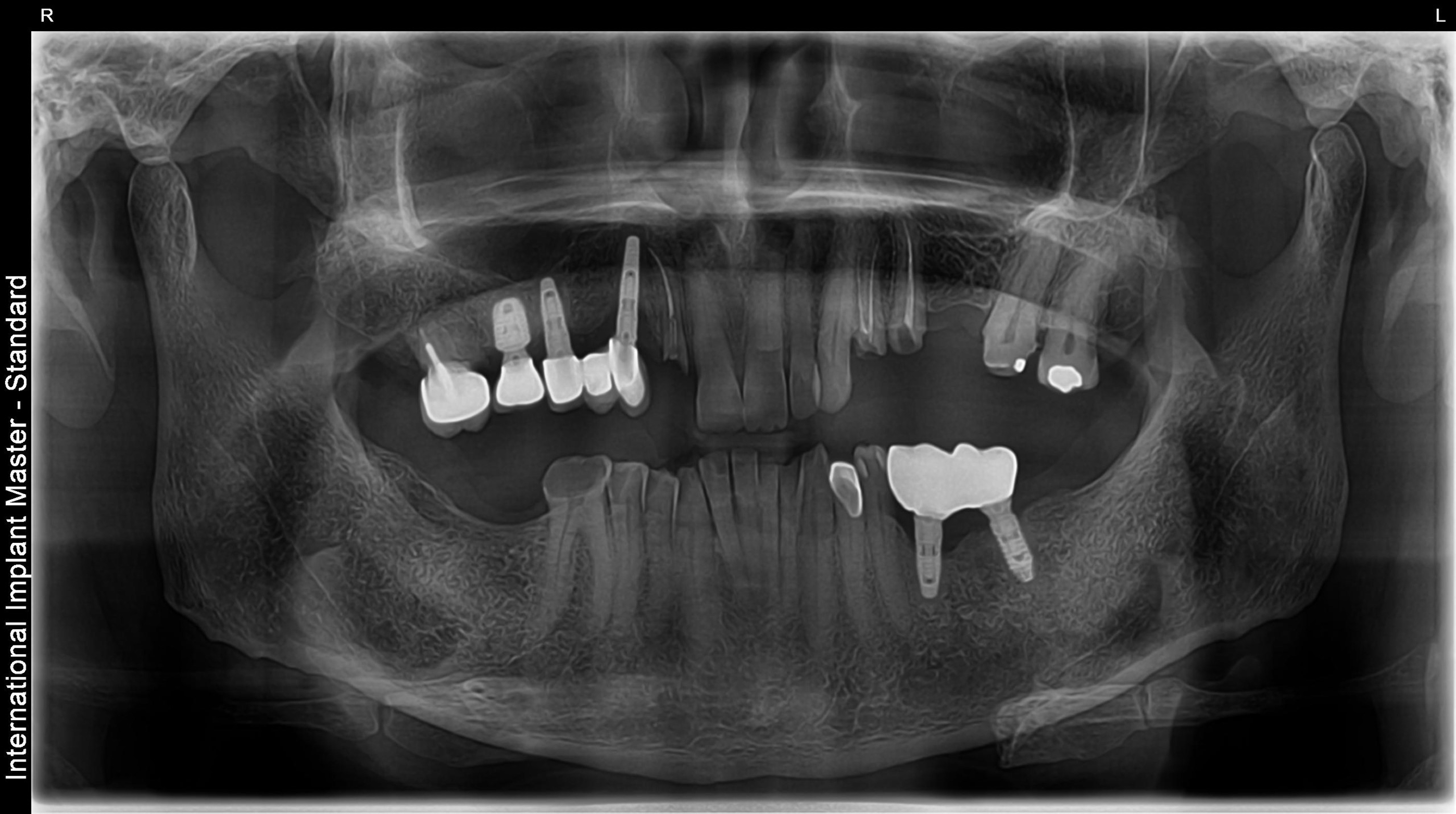 Before image