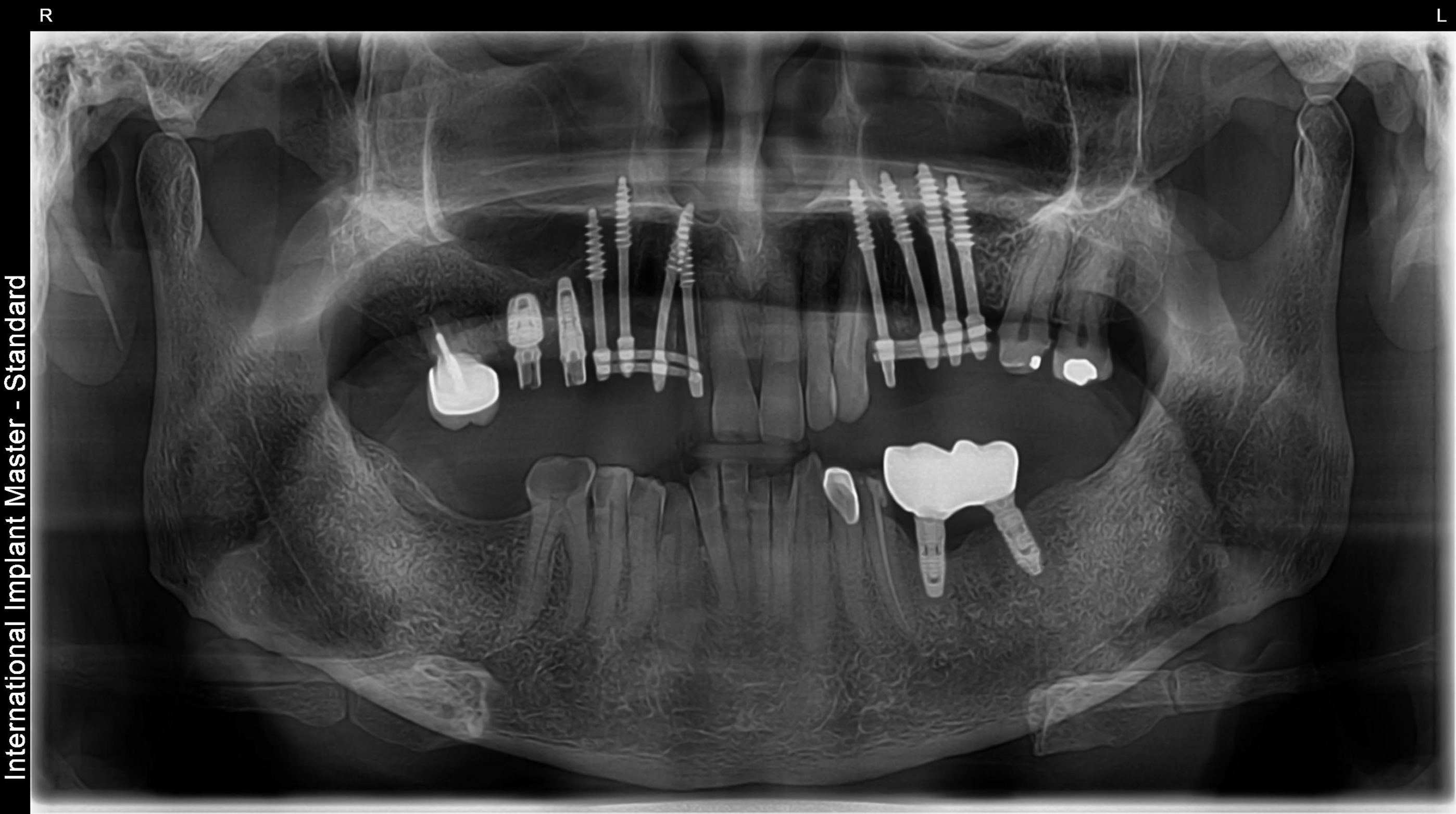 After image