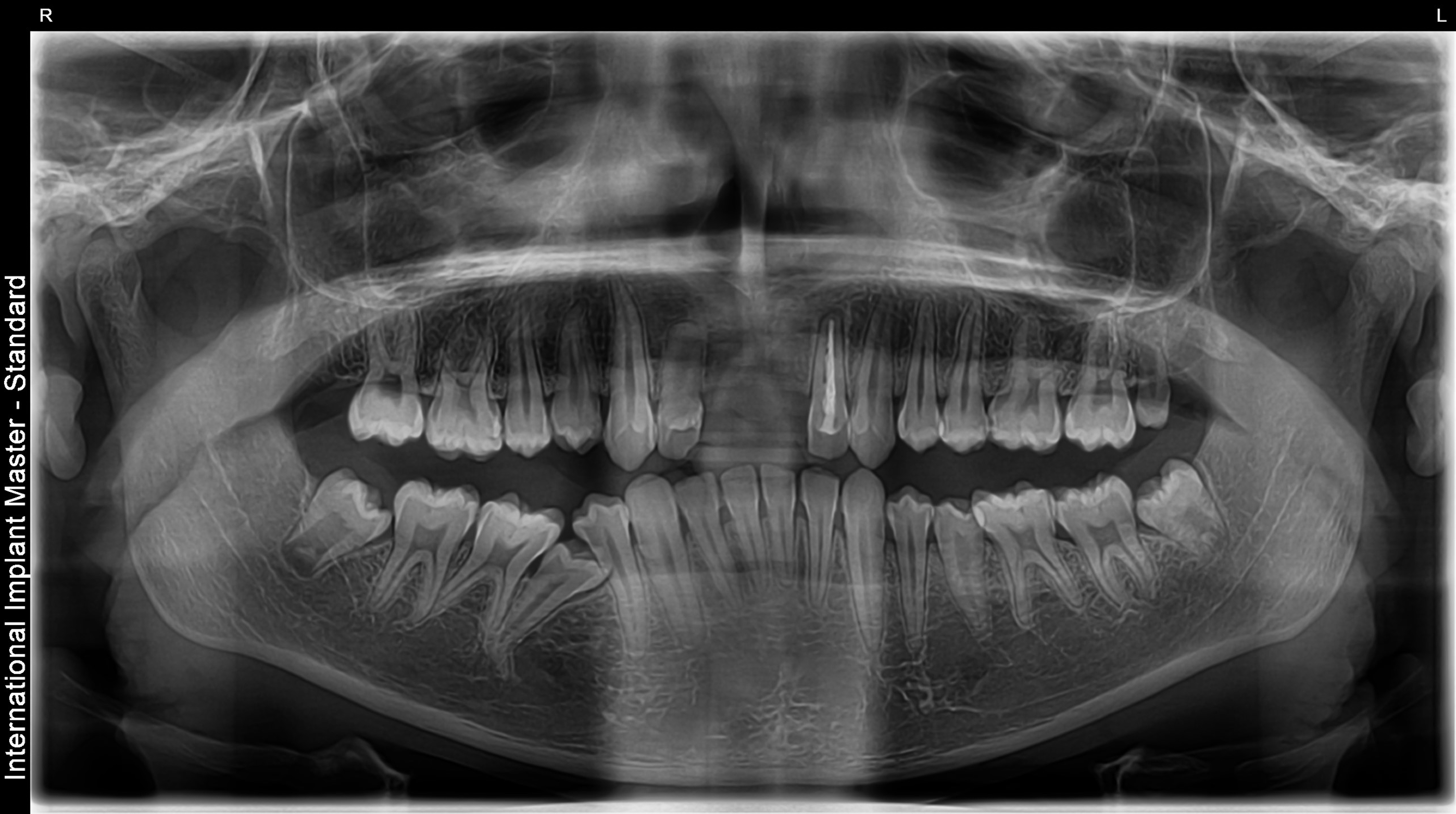Before image