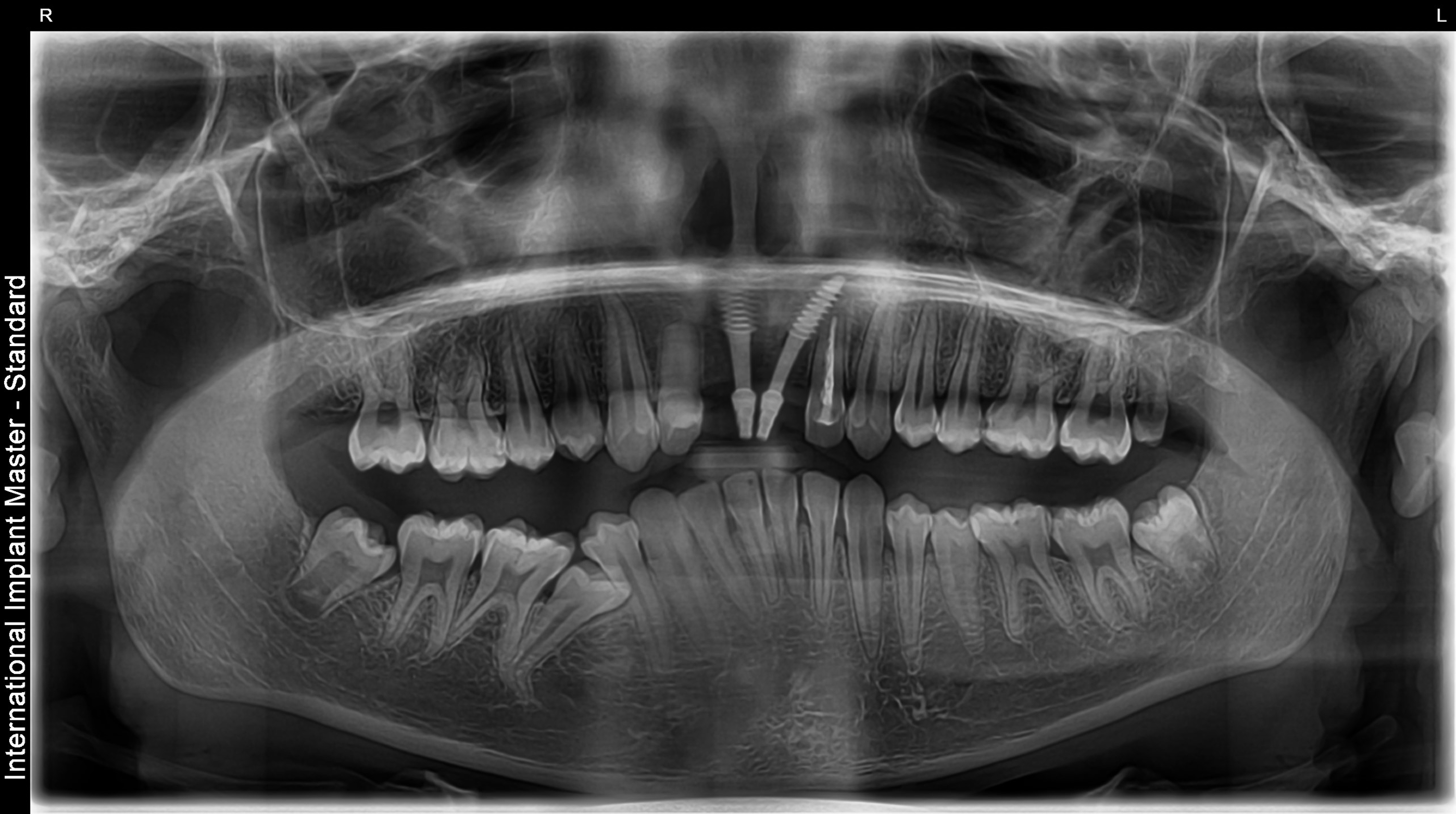 After image