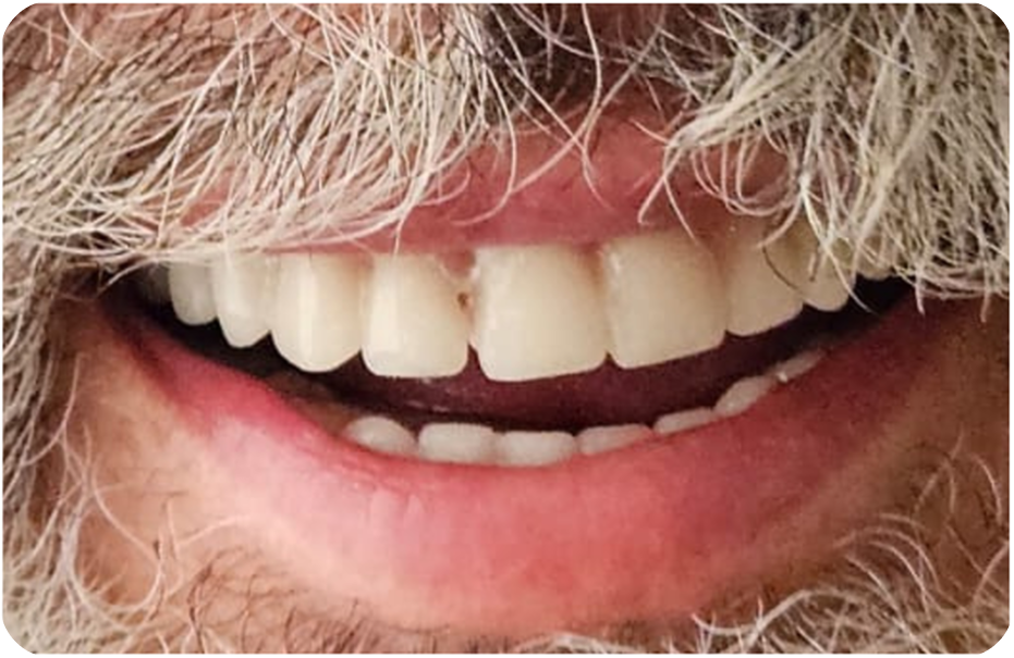 After image